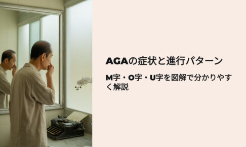 AGAの症状と進行パターン　M字型ハゲ、O字型ハゲ、U字型ハゲを図解で分かりやすく解説