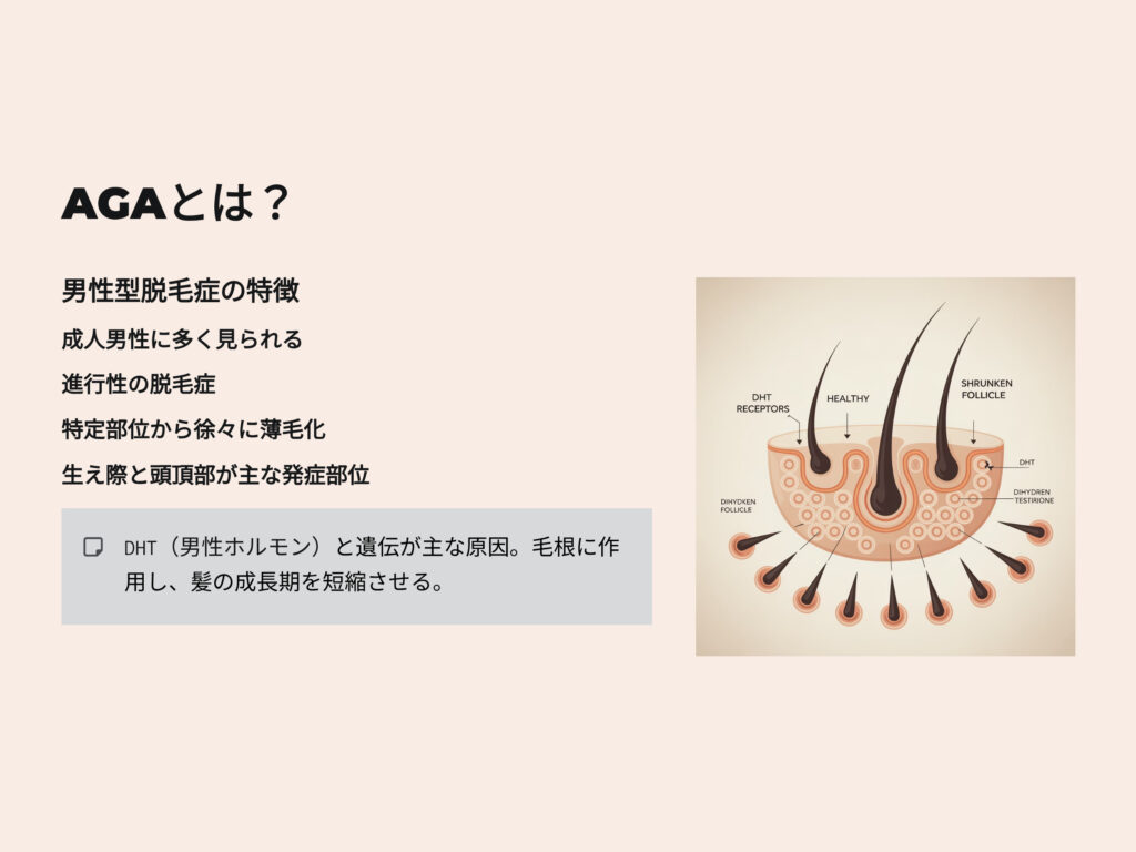 AGAとは
男性型脱毛症の特徴
成人男性に多く見られる
進行性の脱毛症
特定部位から徐々に薄毛化
生え際と頭頂部が主な発症部位
DHT男性ホルモンと遺伝が主な原因　毛根に作用し髪の成長期を短縮させる
