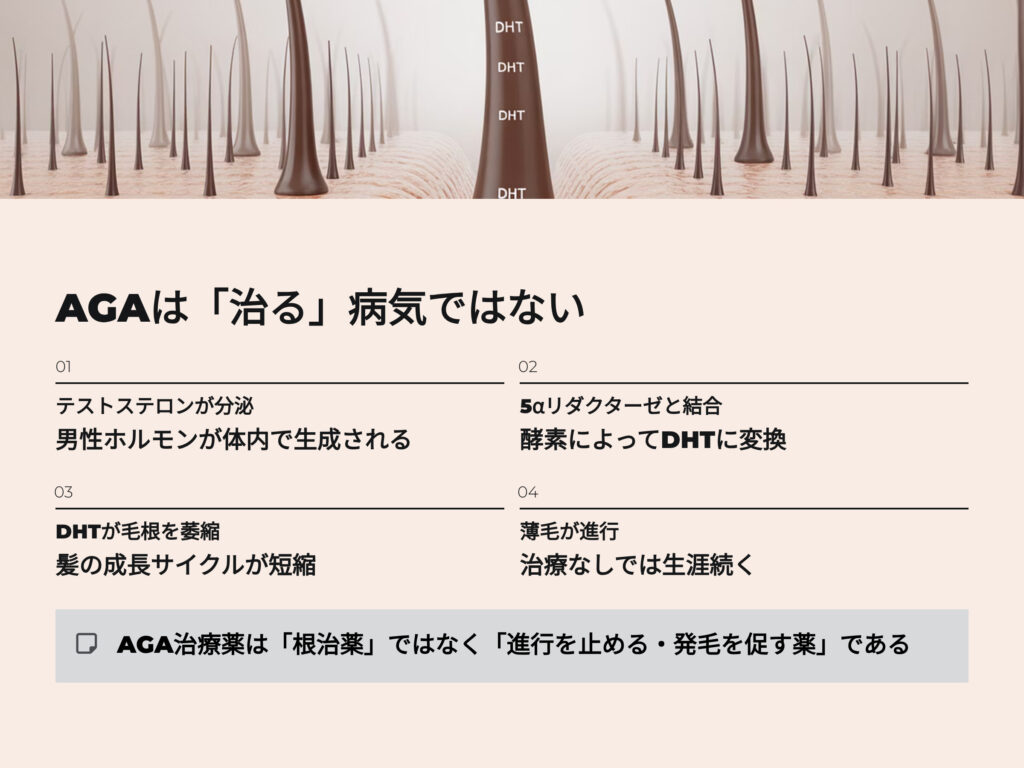 AGA(男性型脱毛症)は、男性ホルモン「テストステロン」が
酵素「5αリダクターゼ」によって「ジヒドロテストステロン(DHT)」に変換され、
毛根を萎縮させることで発症します。
このDHTは生涯分泌され続けるため、薬で抑えない限りAGAは進行を続けます。
つまり、AGA治療薬(フィナステリド・デュタステリド・ミノキシジル)は
「根治薬」ではなく「進行を止める・発毛を促す薬」なのです