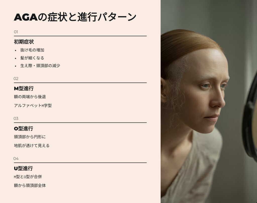 AGAの症状と進行パターン
初期症状
抜け毛の増加
髪が細くなる
生え際、頭頂部の減少
M字型進行
額の両端から後退
アルファベットM字型
O型進行
頭頂部から円形に地肌が透けて見える
U字型進行
M字型とO型が合併
額から頭頂部全体