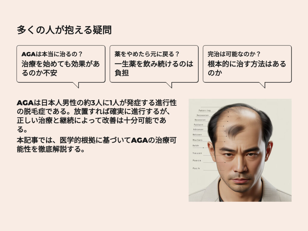 多くの人が抱えるAGAの疑問
AGAは本当に治るの?
治療をはじめても効果があるか不安
薬をやめたら元に戻る?
一生薬を飲み続けるのは負担
完治は可能なのか?
根本的に治す方法はあるのか
AGAは日本人男性の約3人に一人が発症する進行性の脱毛症である
放置すれば確実に進行するが、正しい治療と継続によって改善は十分可能である。
本記事では、医学的根拠に基づいてAGAの治療可能性を徹底解説する。