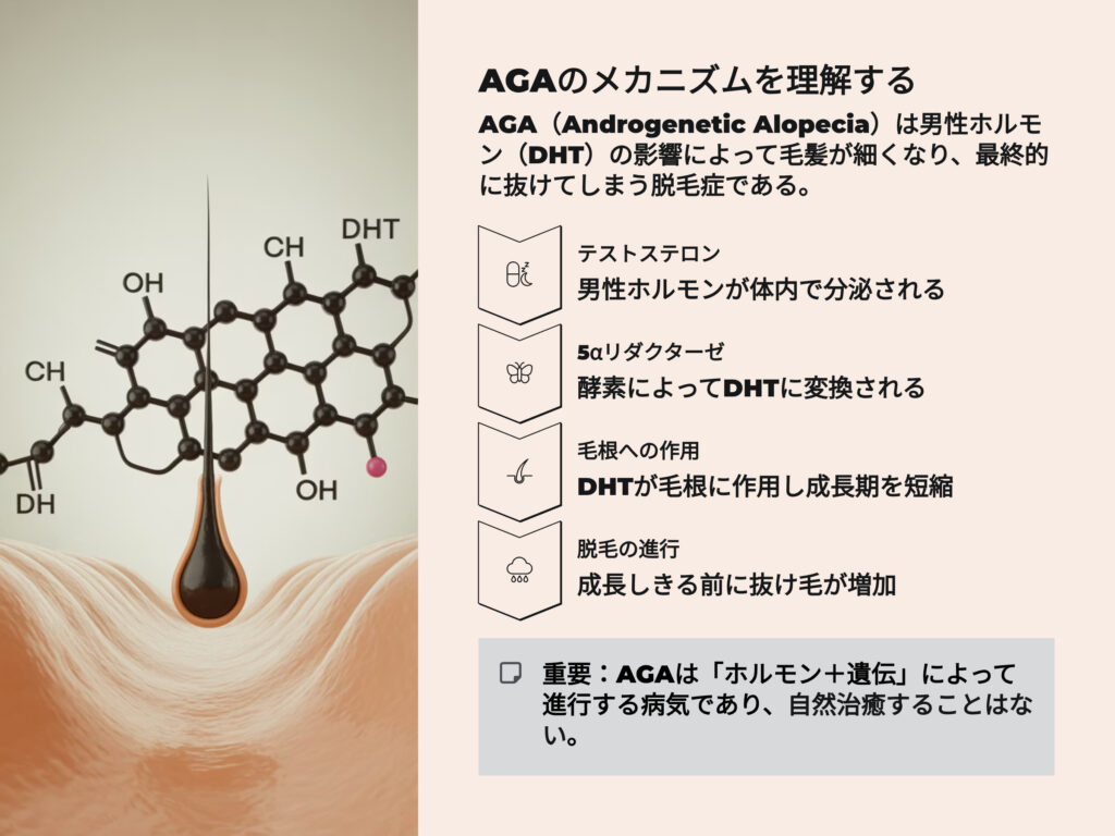 AGAのメカニズムを理解する
AGA(Androgenetic Alopecia)は「男性ホルモン(DHT)」の影響によって毛髪が細くなり、
最終的に抜けてしまう脱毛症のことです。