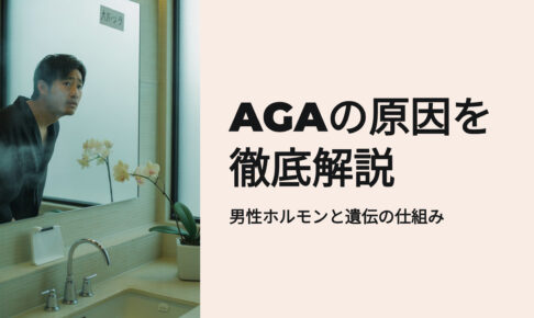 AGAの原因を徹底解説　男性ホルモンと遺伝の仕組み